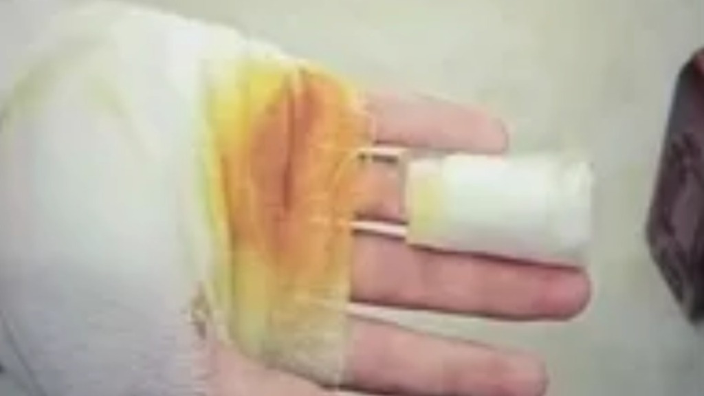 马上评｜中学生被操场地面烫伤，谁的“大课间”？  第1张